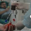 آموزش فصد خون و نبض شناسی