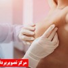 بیوپسی سینه در تهران