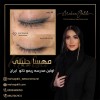 آموزش ریموو تاتو خط چشم در مدرسه تخصصی ریموو تاتو
