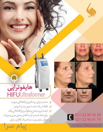 اجاره دستگاه هایفوتراپی   Hifu Ultraformer