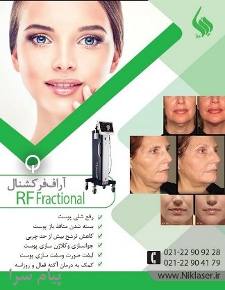 فروش دستگاه آر اف فرکشنال  nettle 
