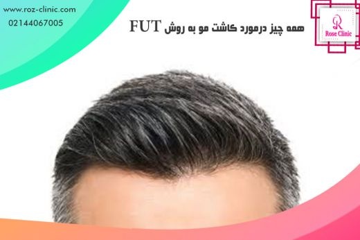 کاشت مو کلینیک رز
