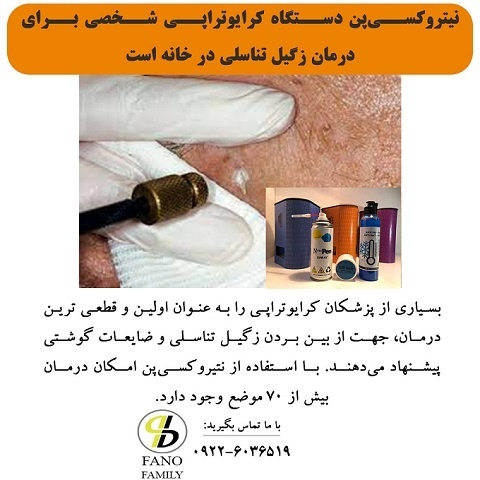 کرایوتراپی زگیل تناسلی با استفاده از نیتروکسی‌پن