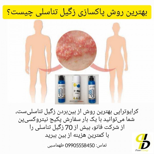 زگیل تناسلی چیست و چگونه کرایوتراپی کنیم؟