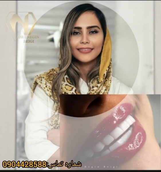 دندانپزشکی زیبایی