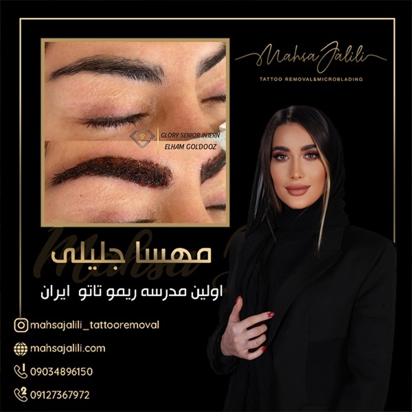 آموزش ریموو تاتو مشکی کاملا تضمینی با مهسا جلیلی