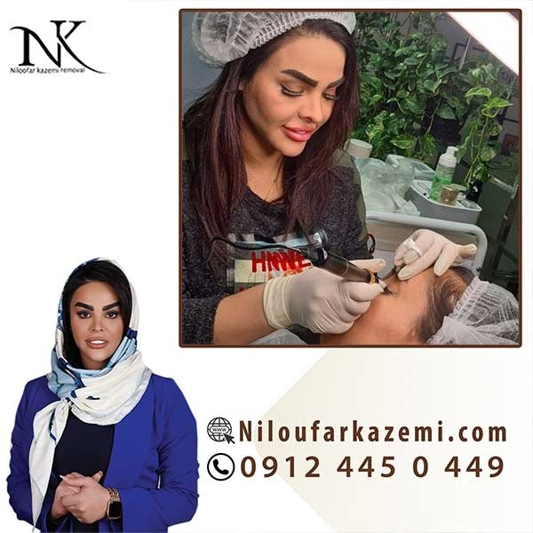 آموزش ریموو تاتو به صورت حرفه ای