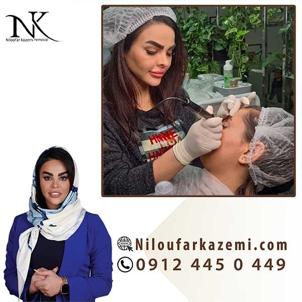 آموزش ریموو تاتو با بروزترین تکنیک در تهران