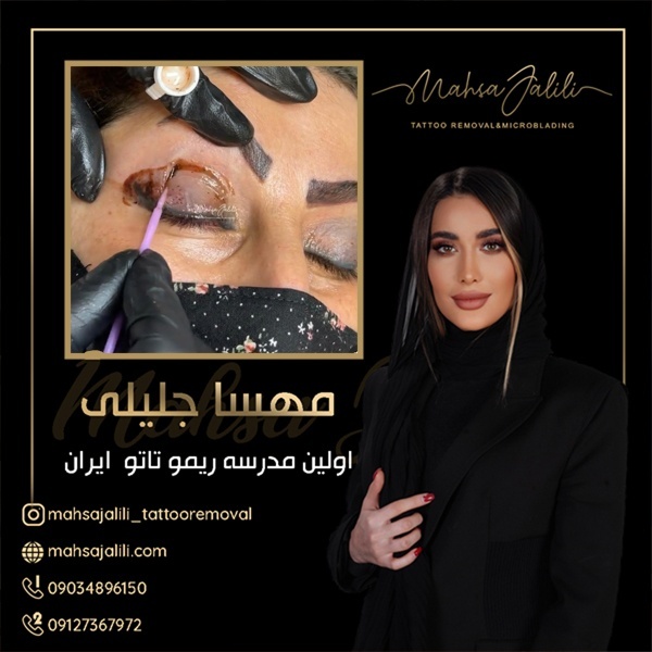 ریموو تاتو خط چشم بدون هیچ حساسیتی