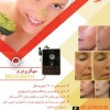 فروش دستگاه میکرودرم سالنی